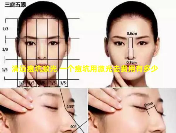 清远痘坑激光 一个痘坑用激光去费用有多少